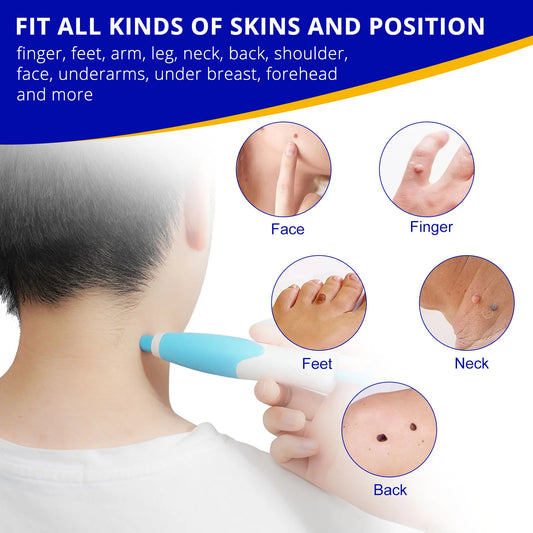 QuickFix Wart & Skin Tag Remover - Affordable Essentials