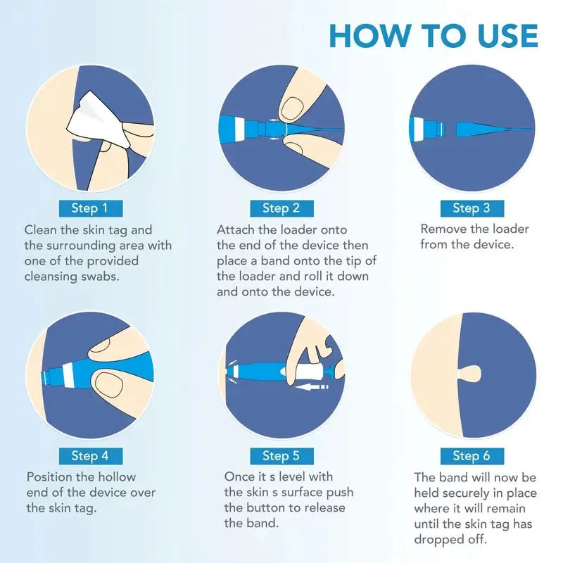 QuickFix Wart & Skin Tag Remover - Affordable Essentials 