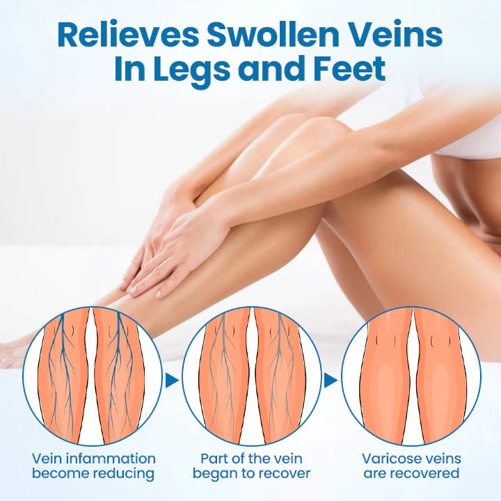 Herbal Vein Relief Spray