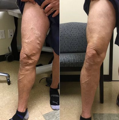 Herbal Vein Relief Spray